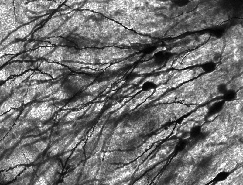 neurons and synapses